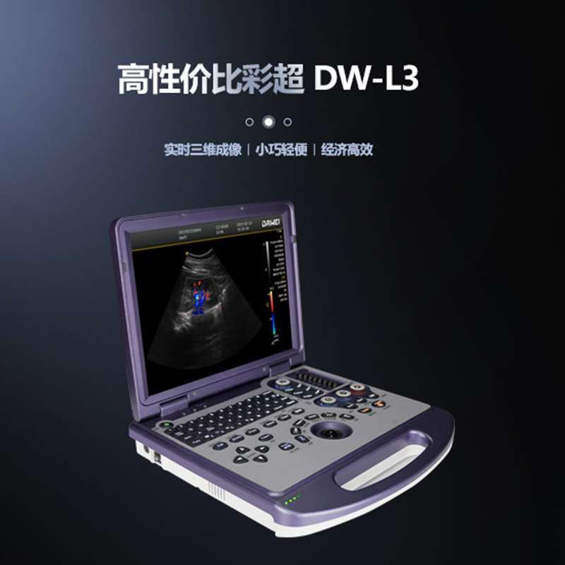 大为笔记本式彩色多普勒超声诊断仪 DW-